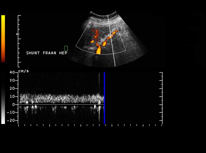 3d av  Catherine Olsson, sonograf